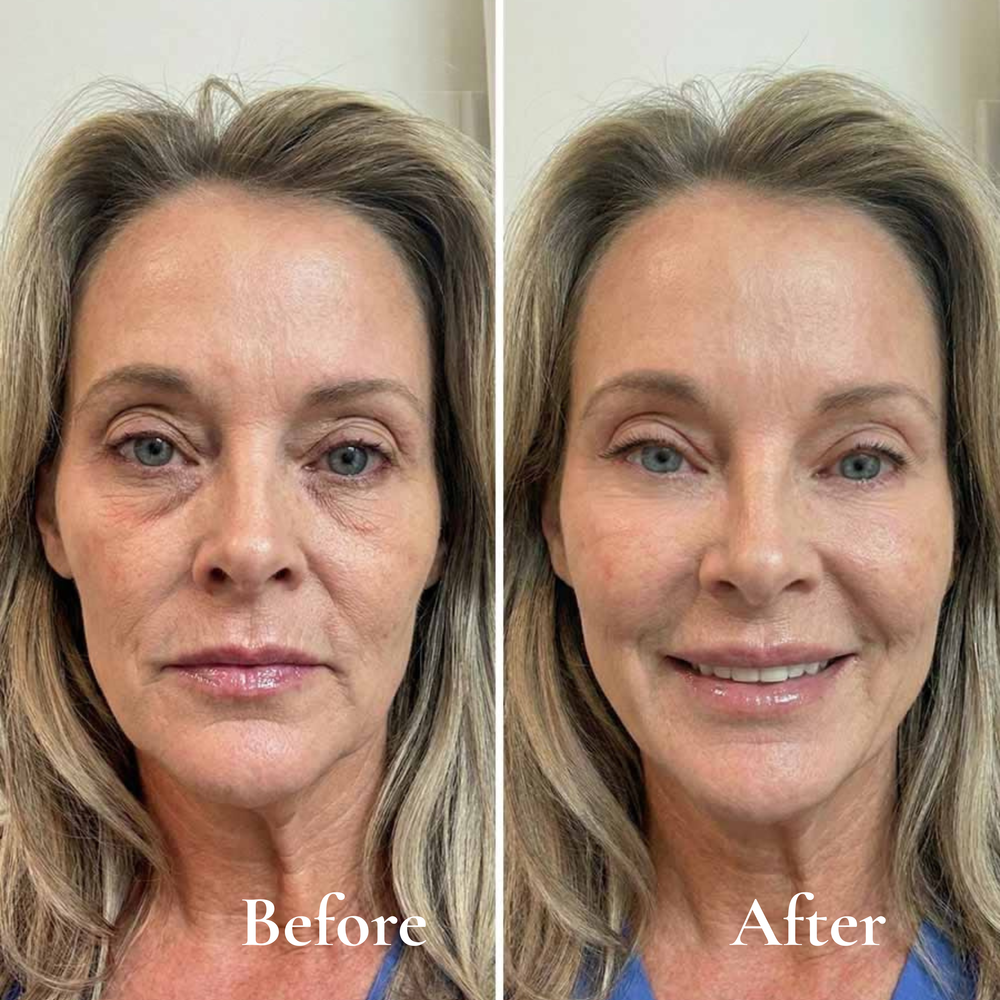 Grace C. , Age: 42